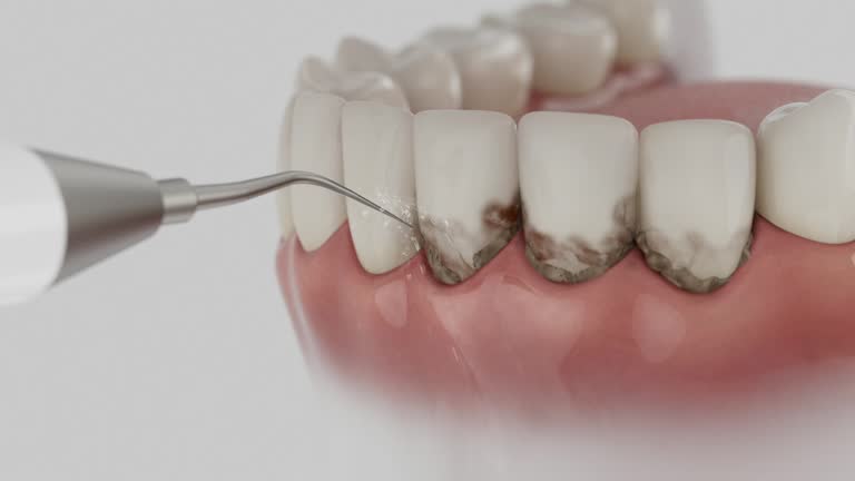 Reliable Dental Implants contractor in Yutan, NE by Smile Center Dentistry